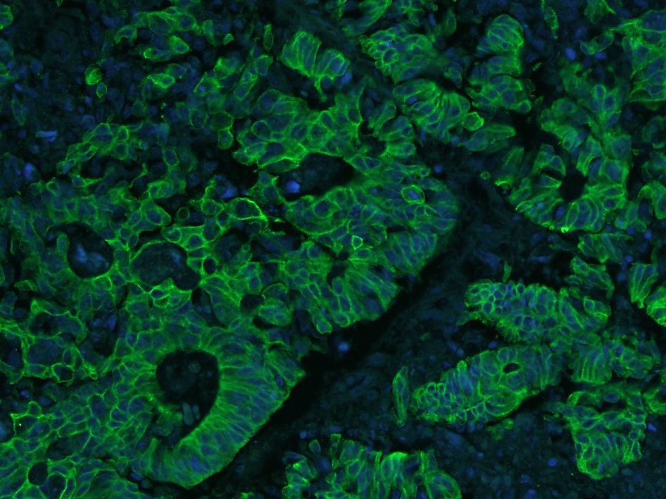 Anti-Cytokeratin 8 Antibody (5G219)