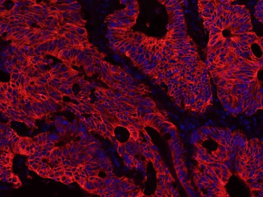 Anti-Cytokeratin 8 Antibody (5G219)
