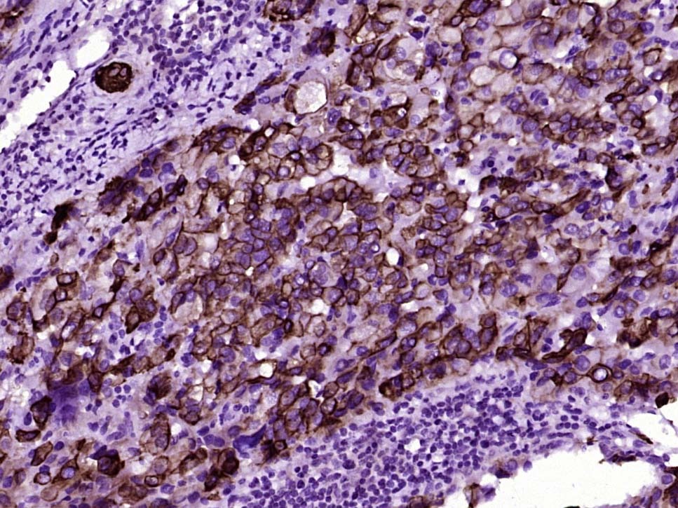 Anti-Cytokeratin 8 Antibody (5G219)
