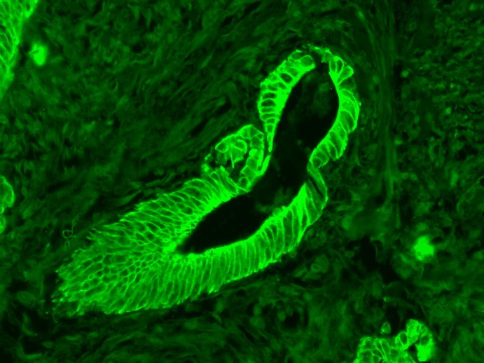 Anti-Cytokeratin 8 Antibody (5G219)