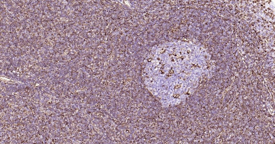 Anti-Vimentin Antibody (3C354)