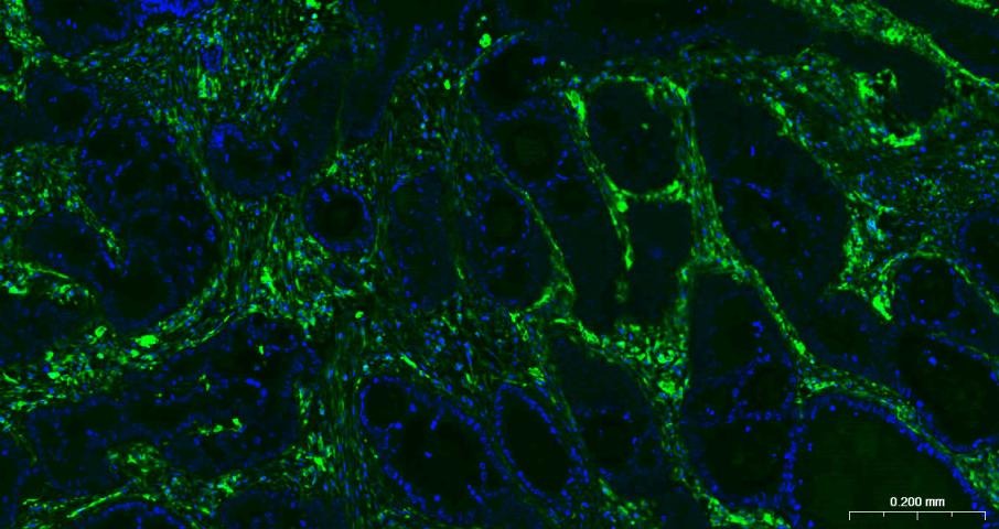 Anti-Vimentin Antibody (3C354)
