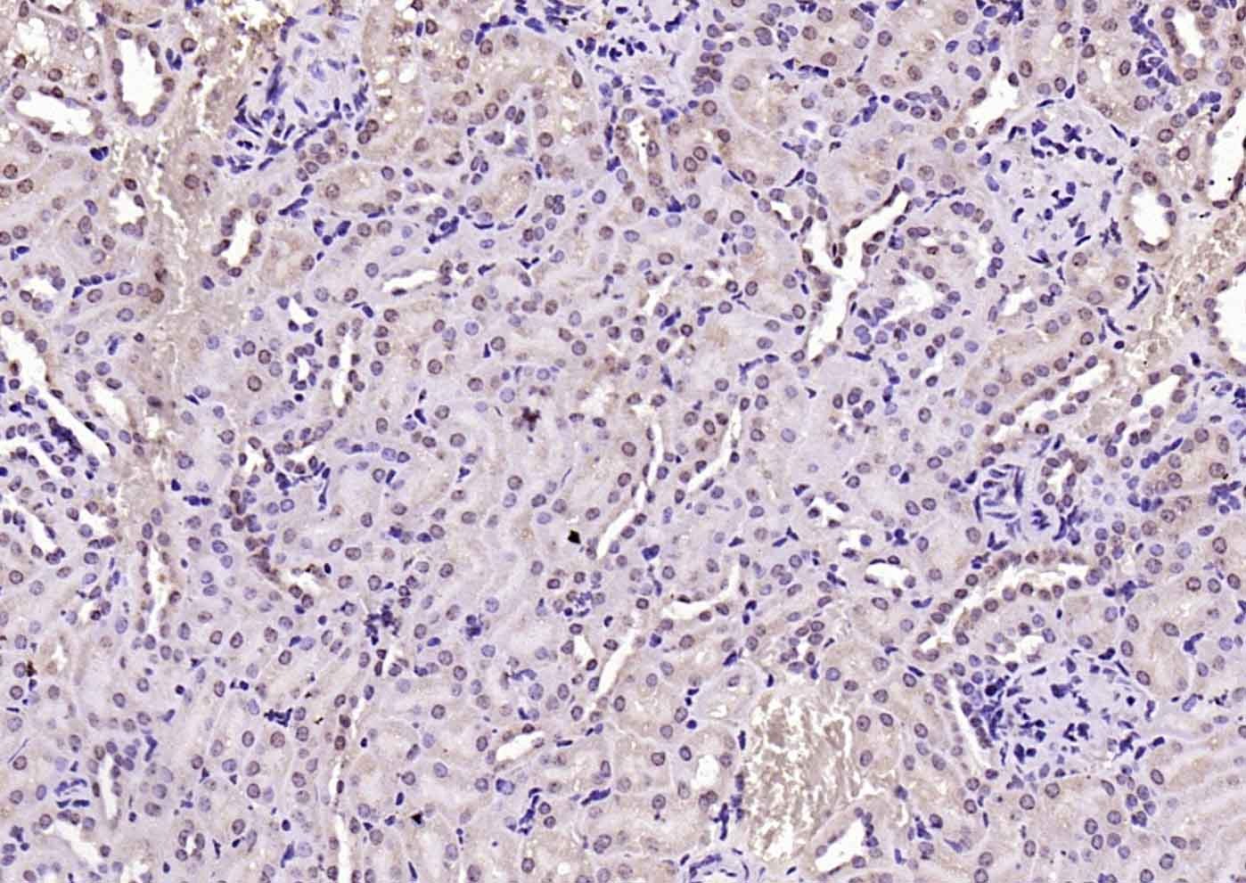 Anti-VEGFR3/FLT4 Polyclonal Antibody