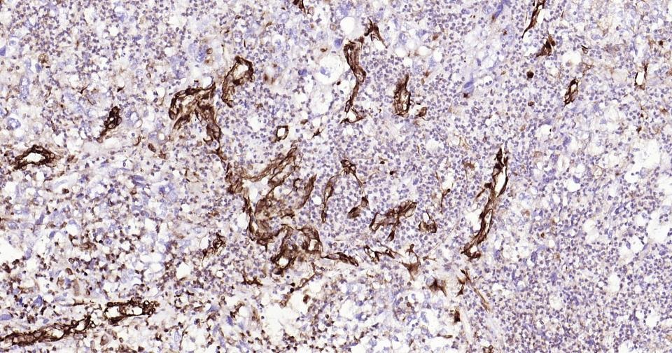Anti-Vimentin Antibody (3C354)