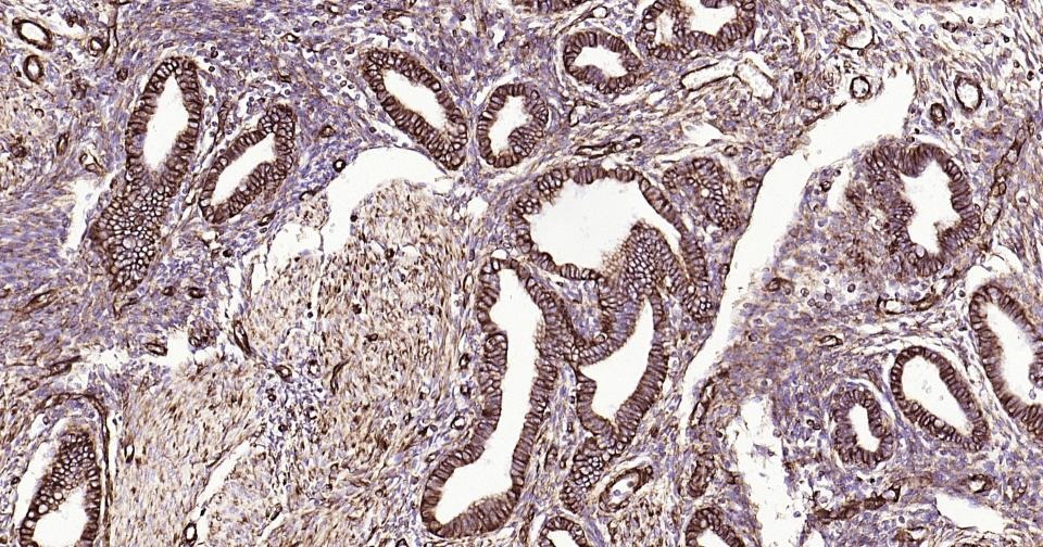 Anti-Vimentin Antibody (3C354)