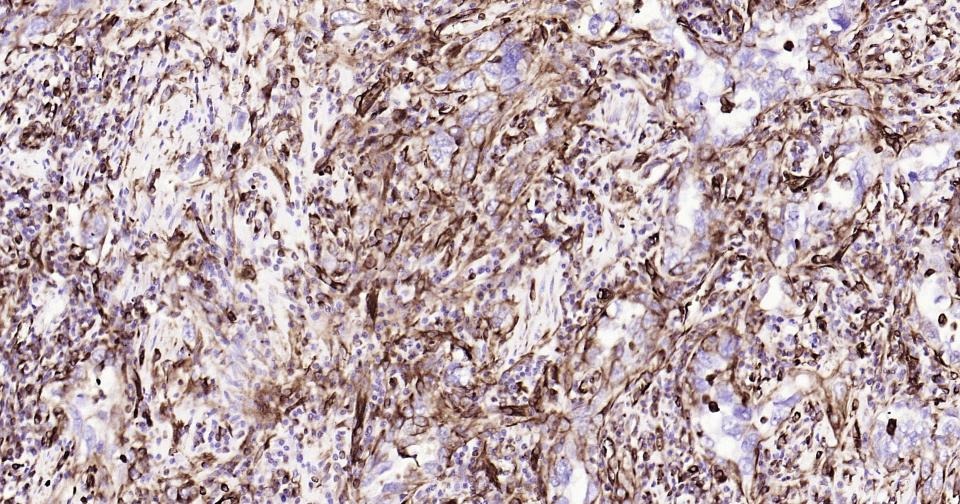 Anti-Vimentin Antibody (3C354)
