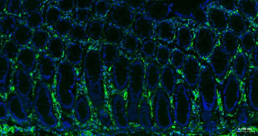 Anti-Vimentin Antibody (3C354)