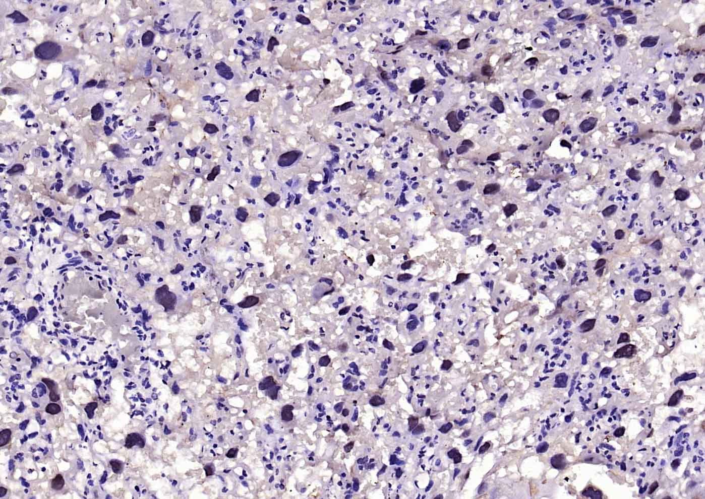 Anti-VEGFR3/FLT4 Polyclonal Antibody