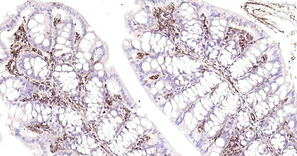 Anti-Vimentin Polyclonal Antibody