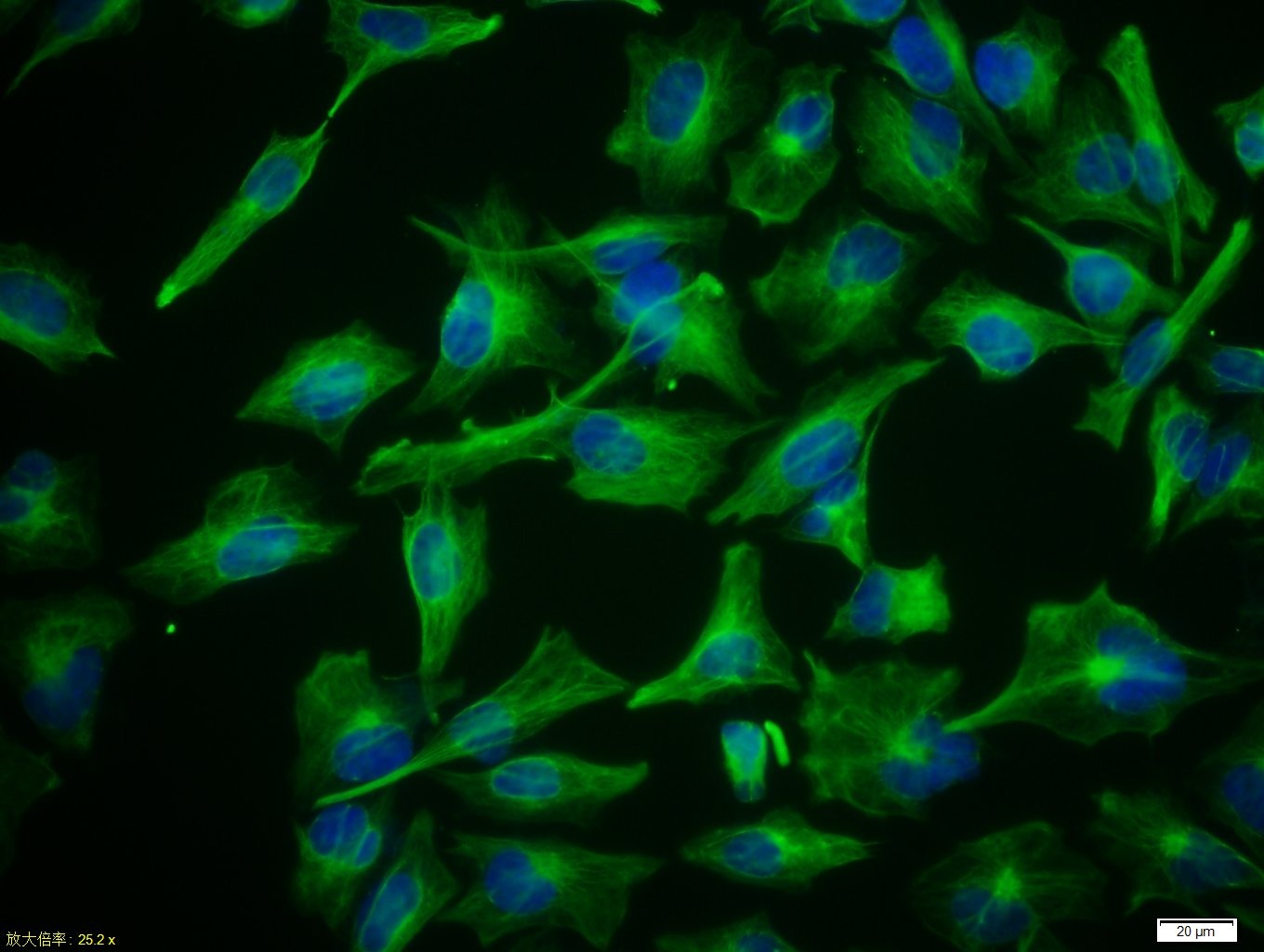 Anti-Vimentin Polyclonal Antibody