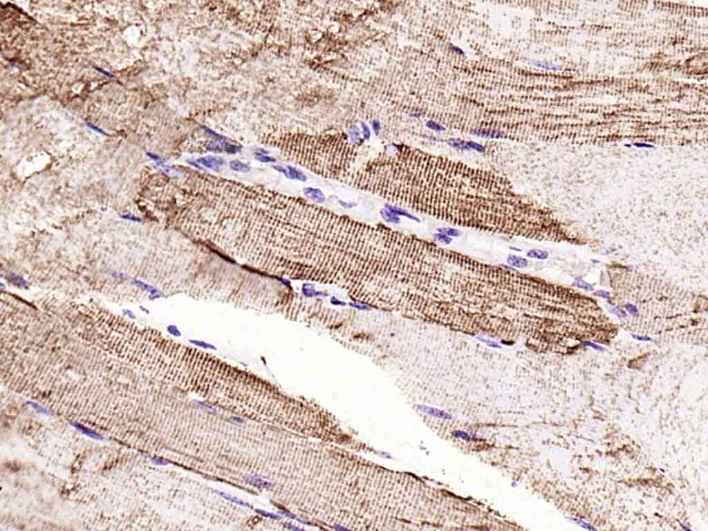 VDAC1 Mitochondrial Loading Control Antibody (5D173)