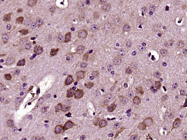 Anti-VCAN Polyclonal Antibody