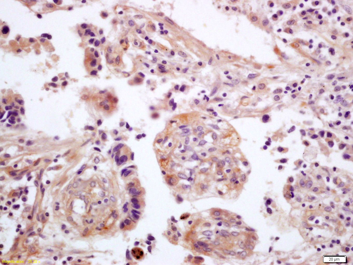 Anti-Wnt5a Polyclonal Antibody