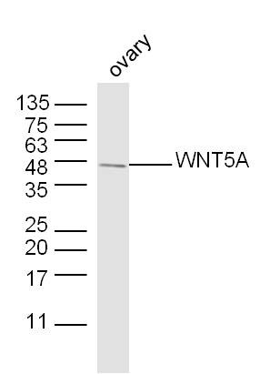 Anti-Wnt5a Polyclonal Antibody