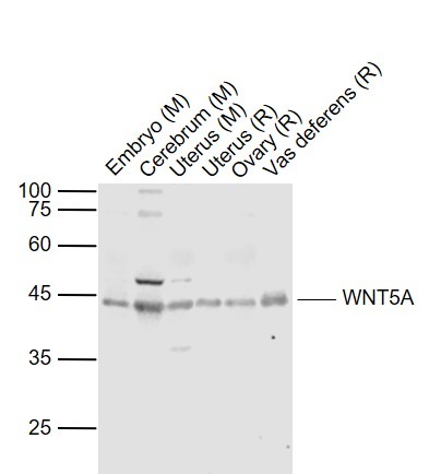 Anti-Wnt5a Polyclonal Antibody