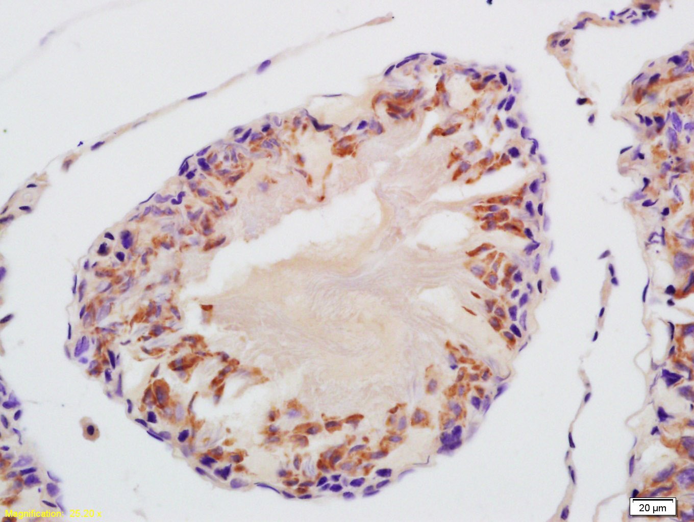 Anti-VDAC3 Polyclonal Antibody