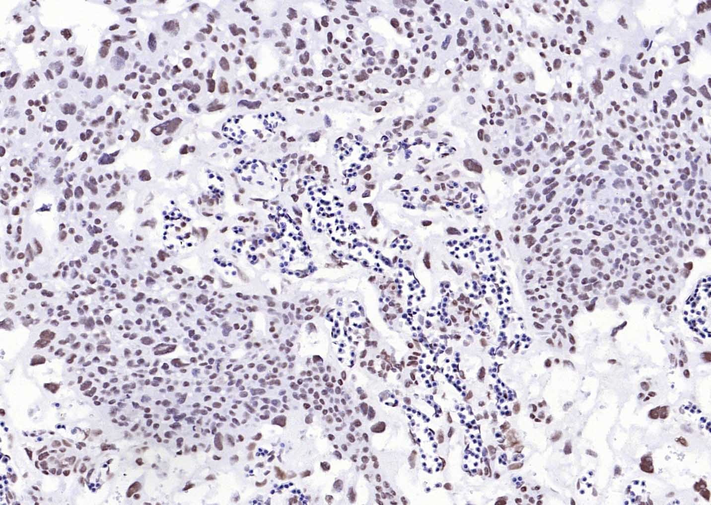 YY1 Nuclear Loading Control Antibody (3P967)