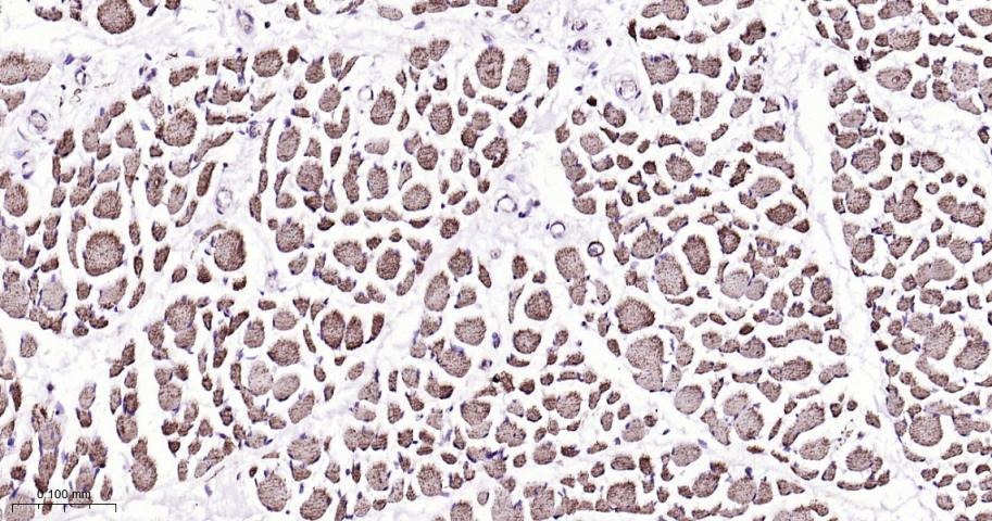 VDAC1 Mitochondrial Loading Control Antibody (5D173)