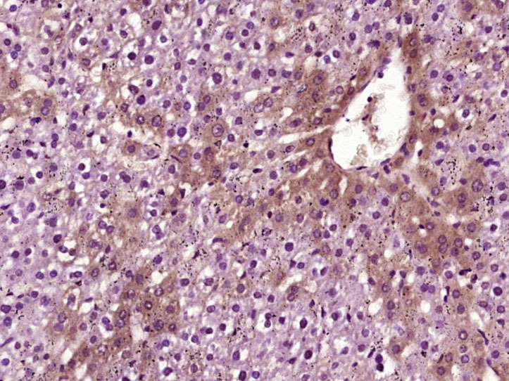 Anti-VEGFA Polyclonal Antibody 6