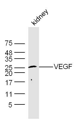 Anti-VEGFA Polyclonal Antibody
