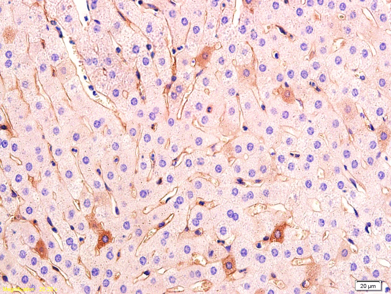 Anti-VEGFA Polyclonal Antibody 2