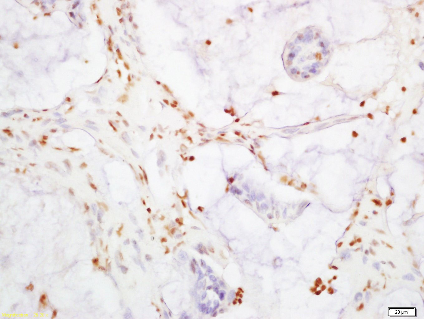 Anti-YAP1 Polyclonal Antibody