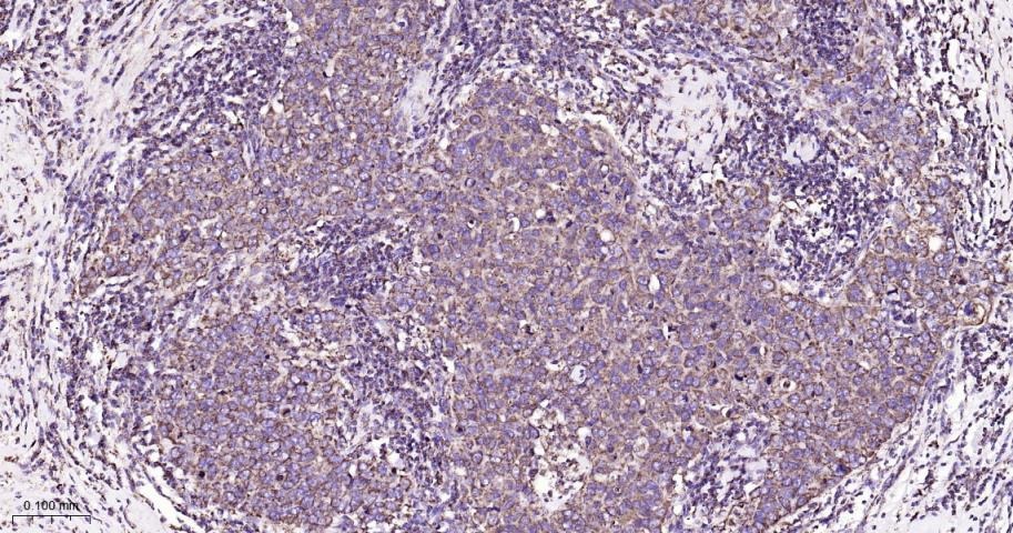 VDAC1 Mitochondrial Loading Control Antibody (5D173)