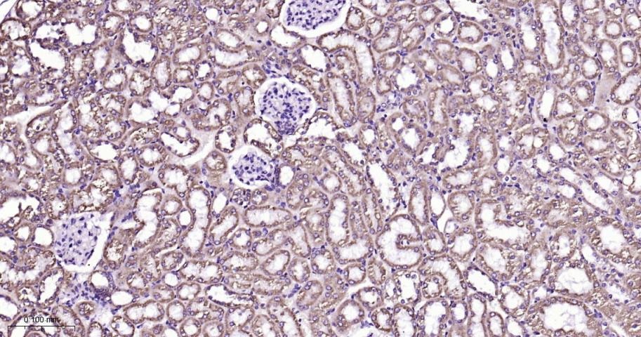 VDAC1 Mitochondrial Loading Control Antibody (5D173)