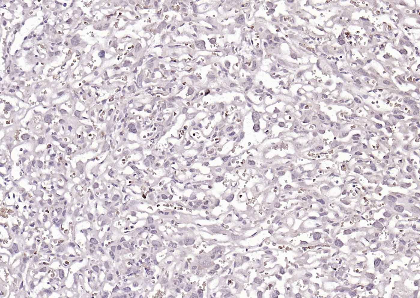 Anti-ZDHHC6 Polyclonal Antibody