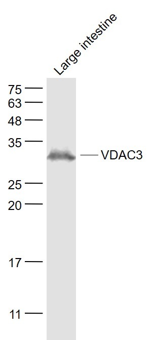 Anti-VDAC3 Polyclonal Antibody