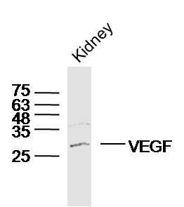 Anti-VEGFA Polyclonal Antibody 2