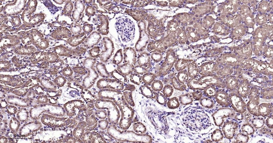 VDAC1 Mitochondrial Loading Control Antibody (5D173)