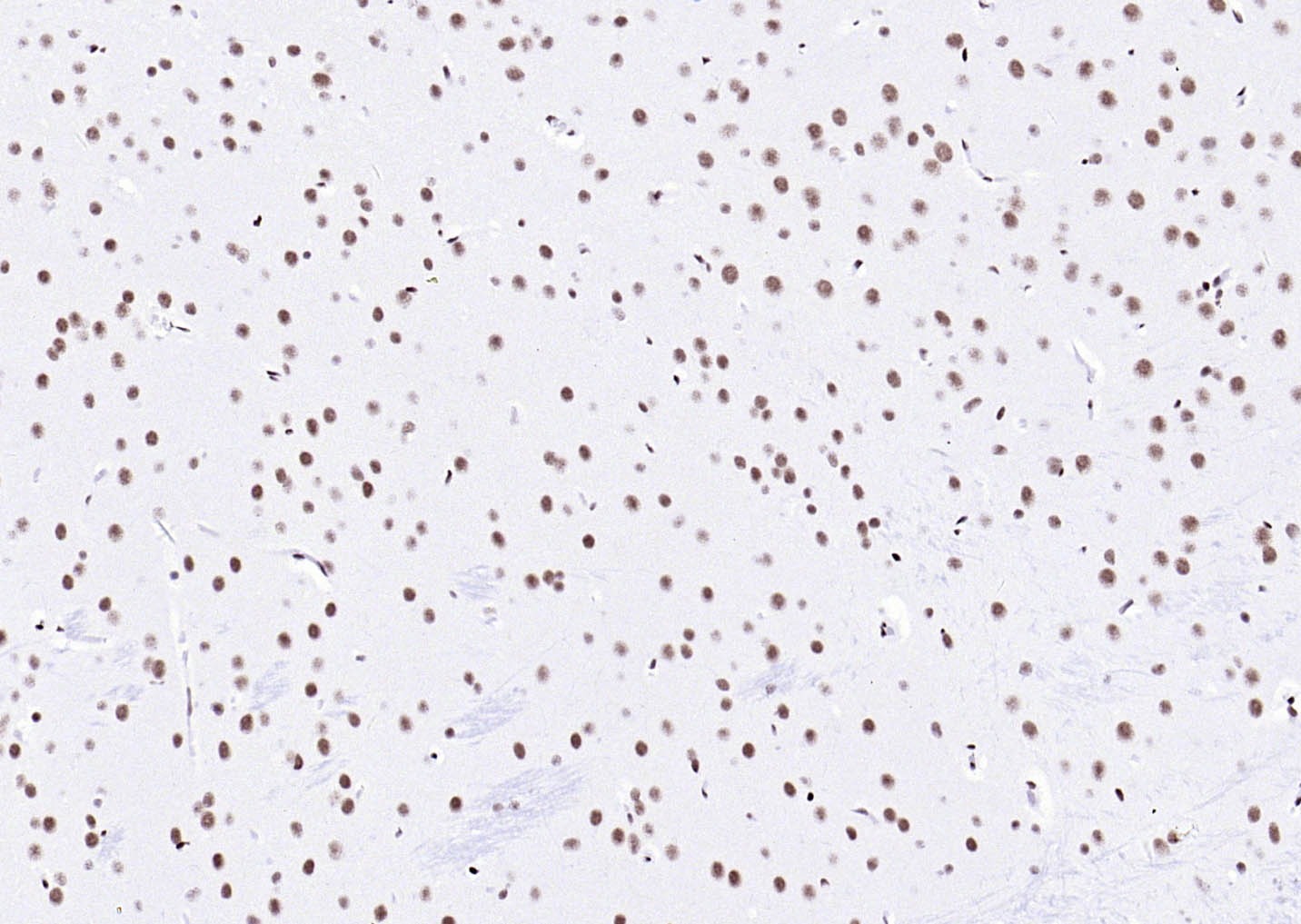 YY1 Nuclear Loading Control Antibody (3P967)