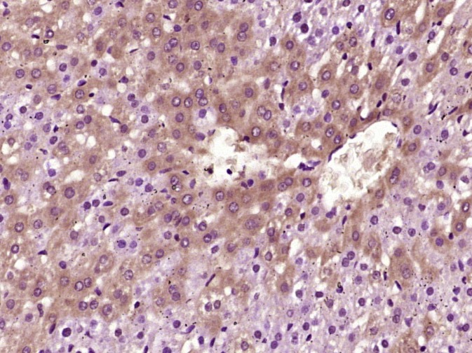 Anti-VEGFA Polyclonal Antibody 5