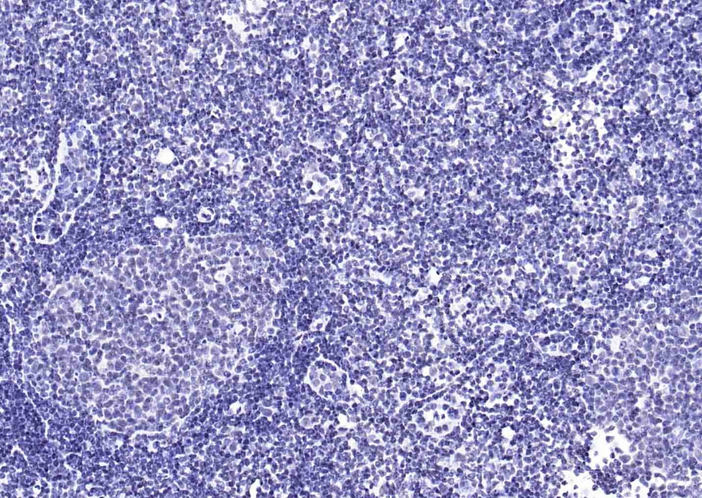YY1 Nuclear Loading Control Antibody (3P967)
