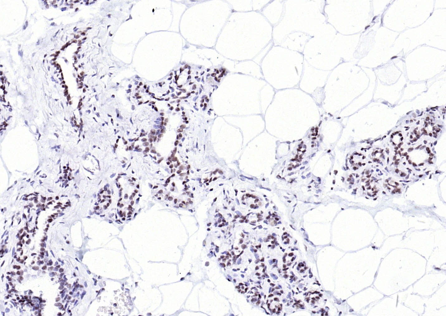 YY1 Nuclear Loading Control Antibody (3P967)
