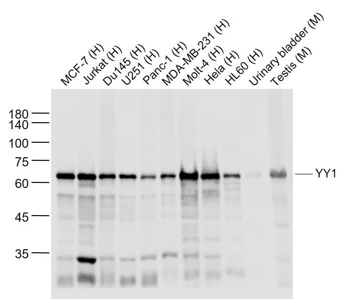 YY1 Nuclear Loading Control Antibody (3P967)