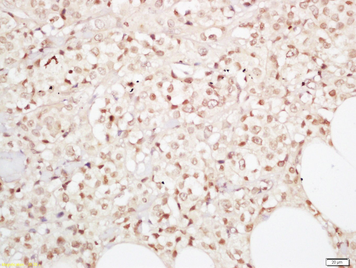 Anti-YAP1 Polyclonal Antibody