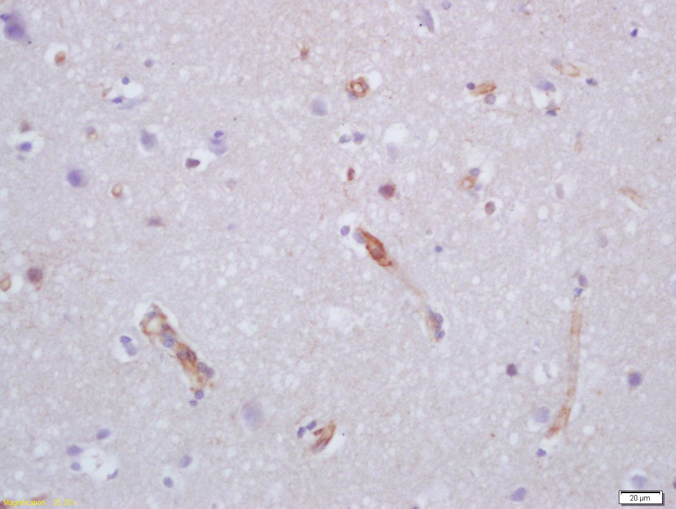 Anti-VEGFA Polyclonal Antibody 3