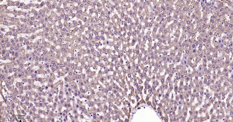 VDAC1 Mitochondrial Loading Control Antibody (5D173)