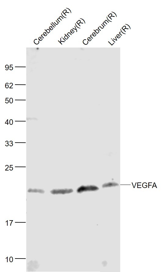 Anti-VEGFA Polyclonal Antibody 5
