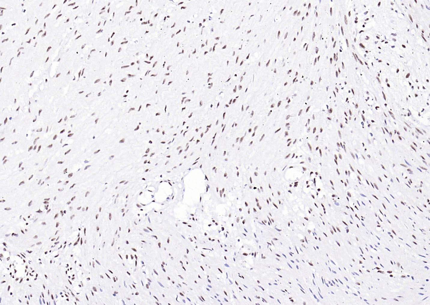 YY1 Nuclear Loading Control Antibody (3P967)