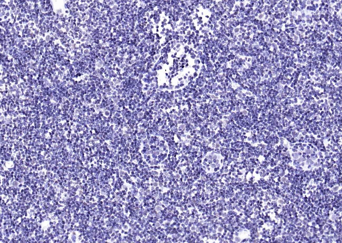 YY1 Nuclear Loading Control Antibody (3P967)