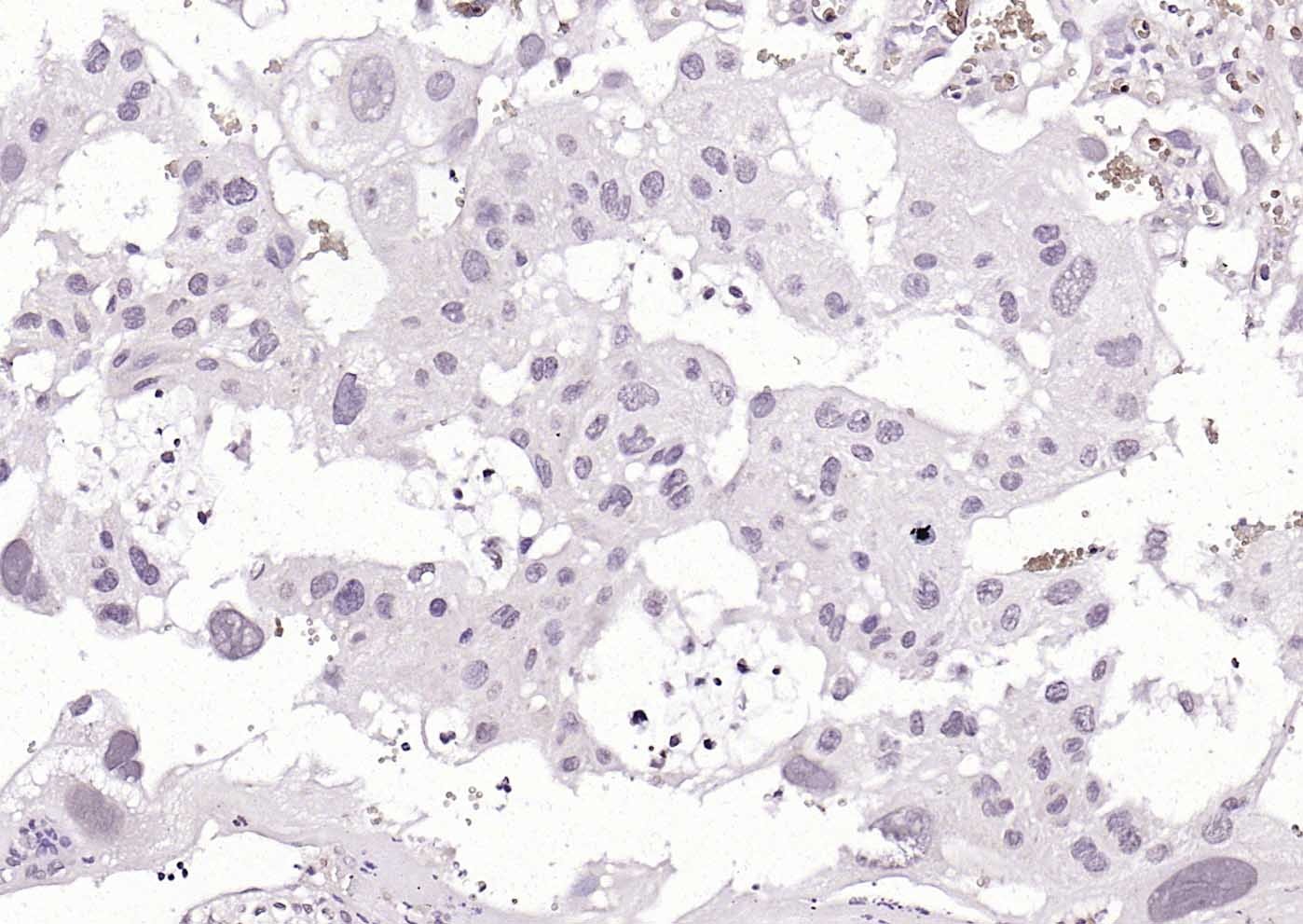 Anti-ZDHHC6 Polyclonal Antibody
