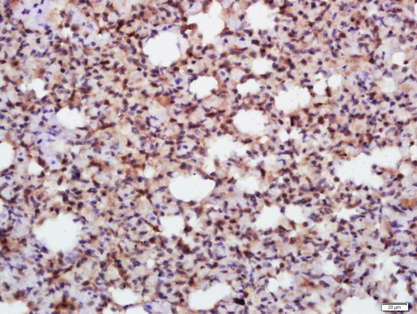 Anti-EIF2S1 Polyclonal Antibody