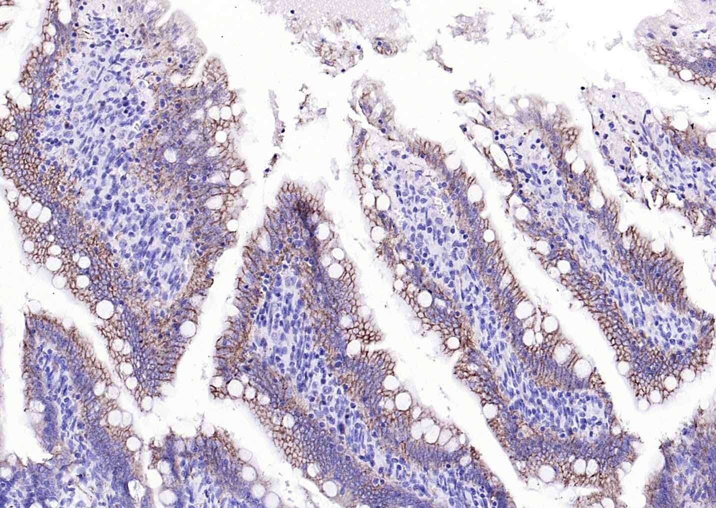 Anti-EMP-1 Polyclonal Antibody