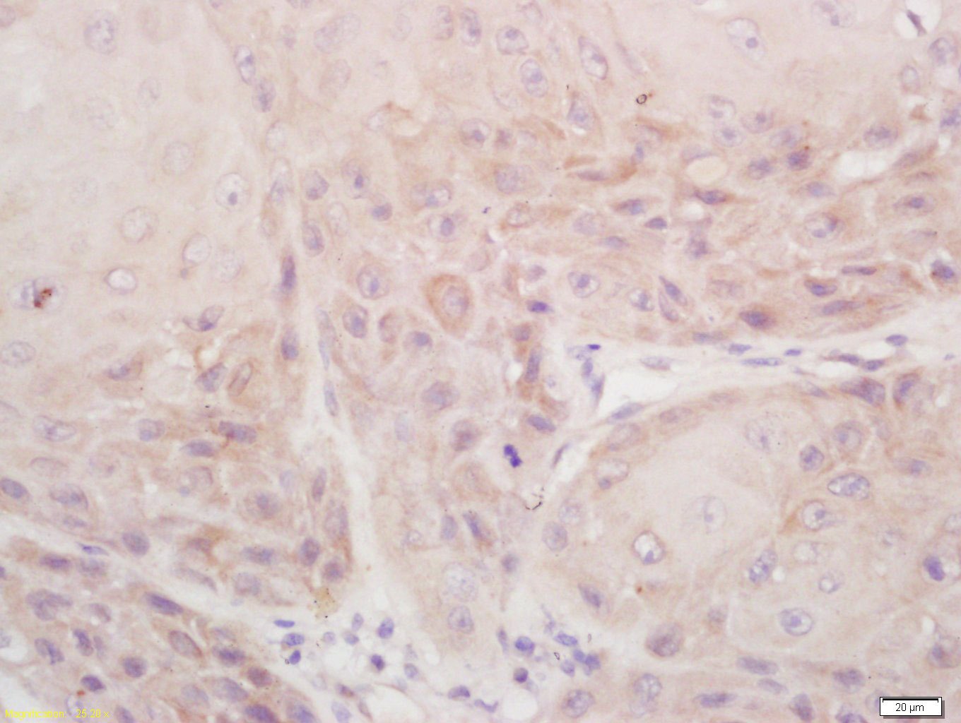Anti-DSPP Polyclonal Antibody
