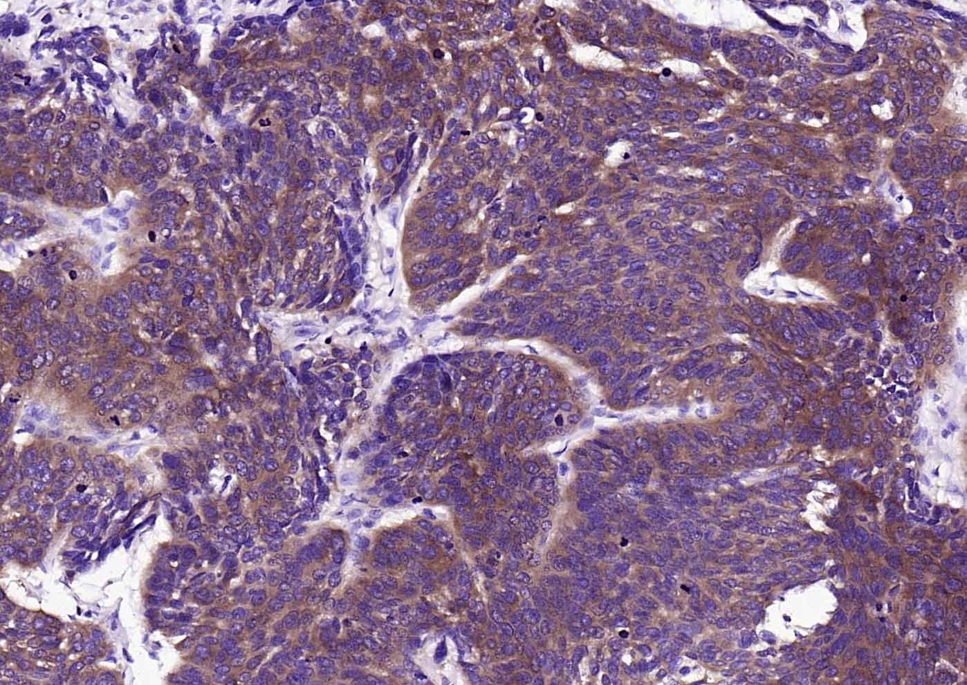 Anti-FASN Antibody (1K266)