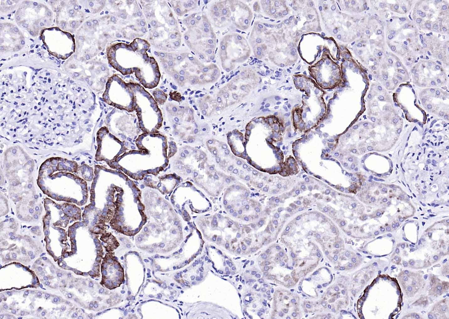 Anti-EMP-1 Polyclonal Antibody
