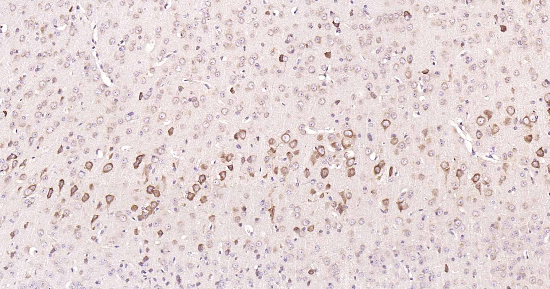 Anti-DDIT3 Polyclonal Antibody